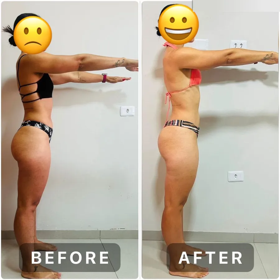 Antes e depois de outra aluna, vista de lado, na mesma pose. Rosto coberto.